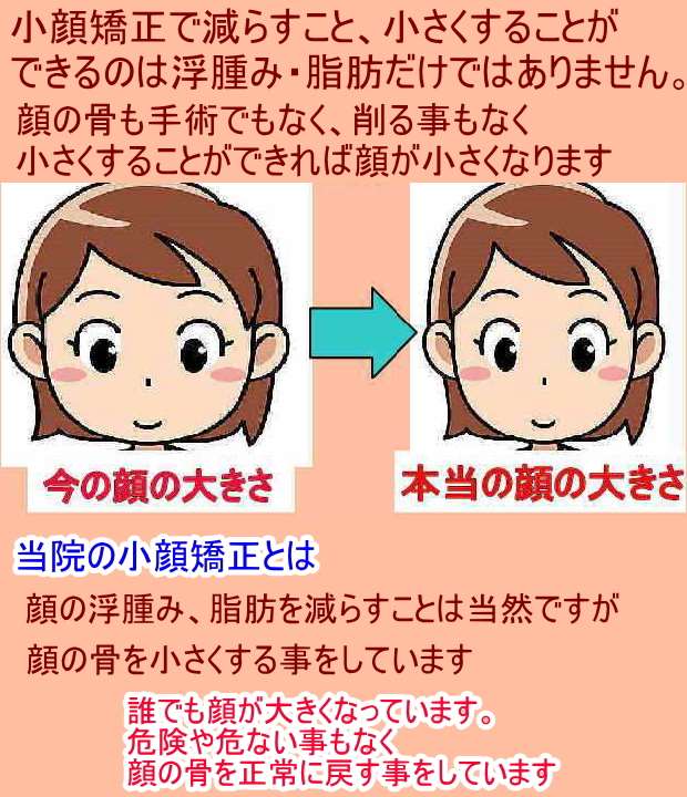 疲れやストレスが溜まると顔が大きくなる