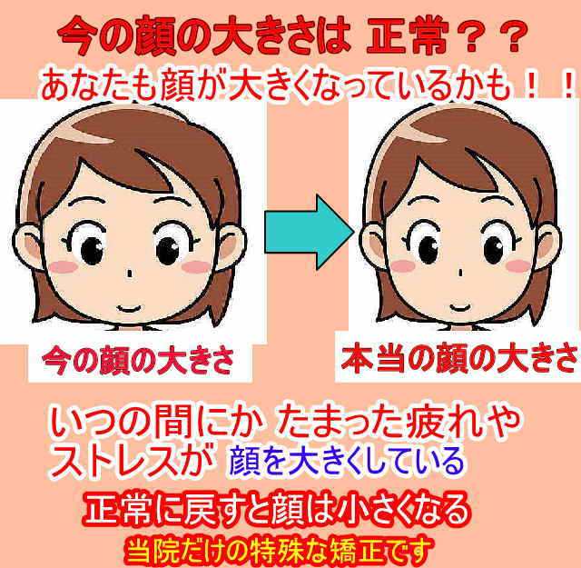 今現在の顔の大きさが正常ではありません