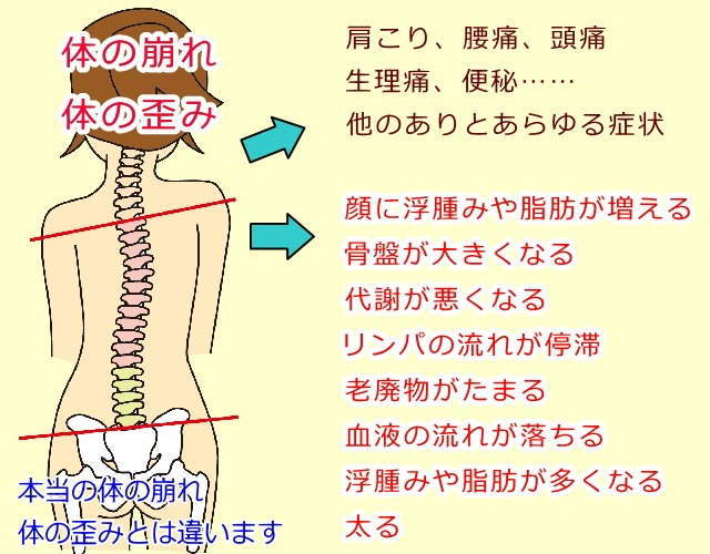 体の崩れ、体の歪み